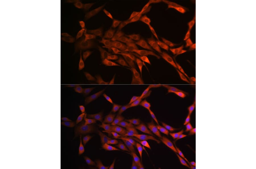 Immunofluorescence - Anti-PAK1 Antibody [ARC0087] (A307809) - Antibodies.com