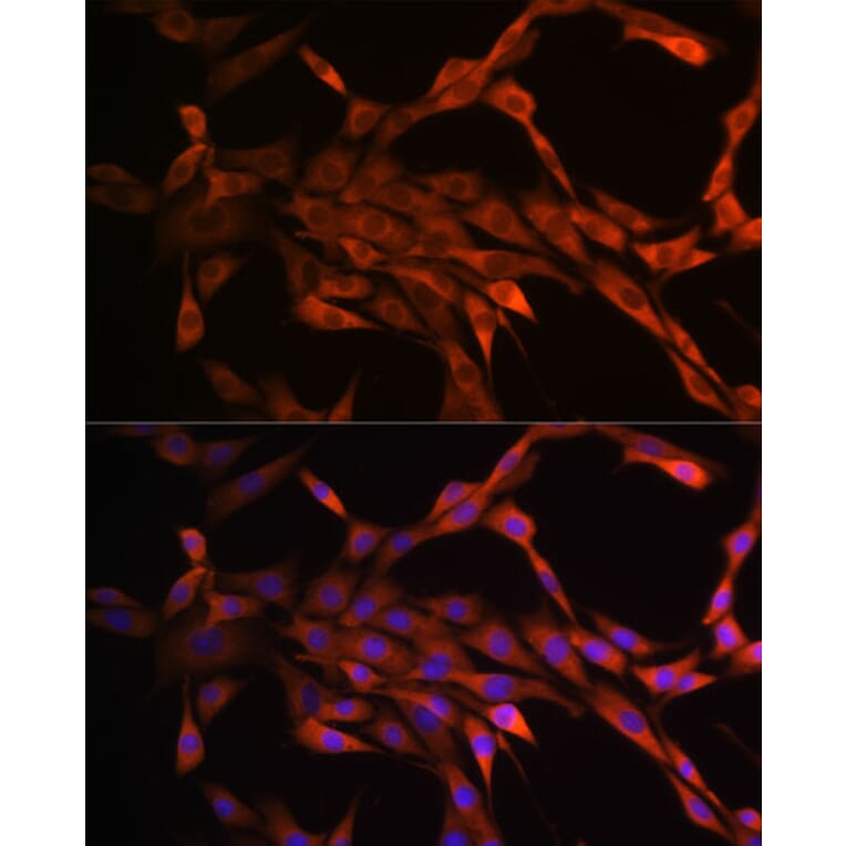Immunofluorescence - Anti-PAK1 Antibody [ARC0087] (A307809) - Antibodies.com