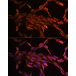Immunofluorescence - Anti-PAK1 Antibody [ARC0087] (A307809) - Antibodies.com