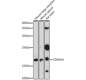 Western Blot - Anti-p21 Antibody (A307811) - Antibodies.com