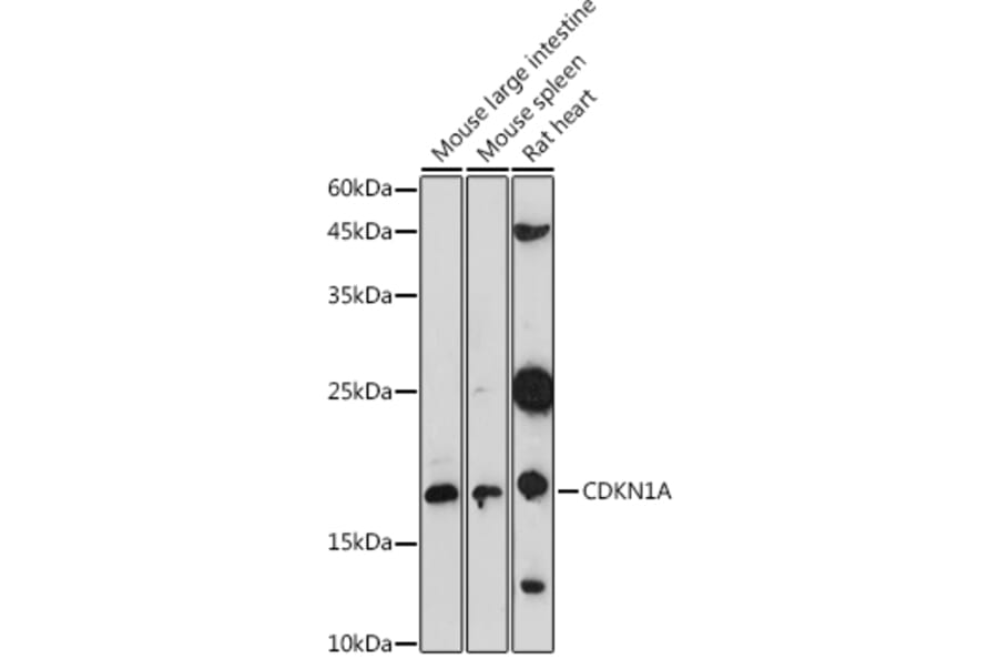 Western Blot - Anti-p21 Antibody (A307811) - Antibodies.com