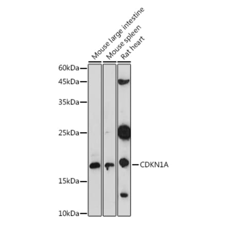 Western Blot - Anti-p21 Antibody (A307811) - Antibodies.com