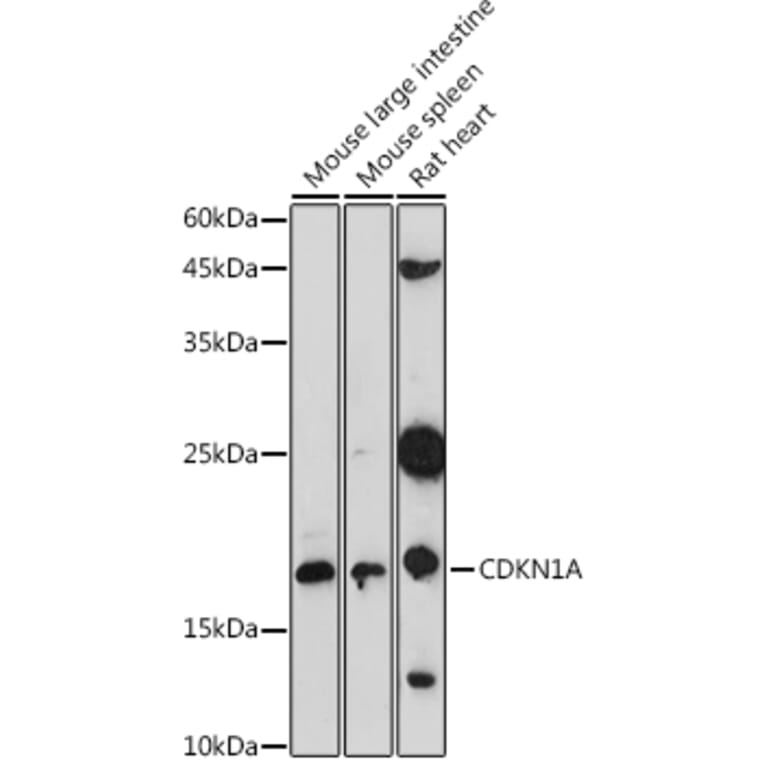 Western Blot - Anti-p21 Antibody (A307811) - Antibodies.com