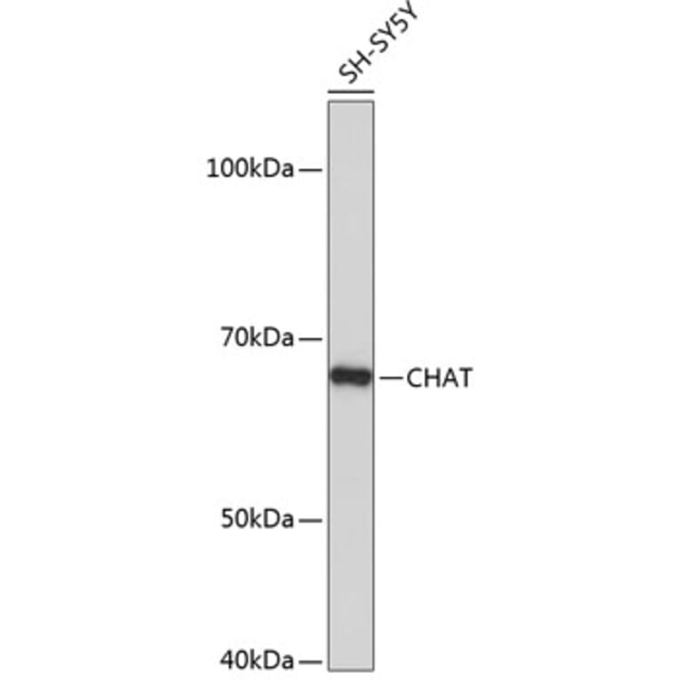 Western Blot - Anti-Choline Acetyltransferase Antibody [ARC0491] (A307812) - Antibodies.com