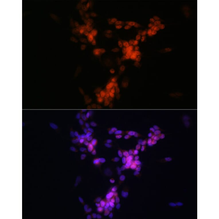 Immunofluorescence - Anti-Choline Acetyltransferase Antibody [ARC0491] (A307812) - Antibodies.com