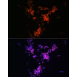 Immunofluorescence - Anti-Choline Acetyltransferase Antibody [ARC0491] (A307812) - Antibodies.com