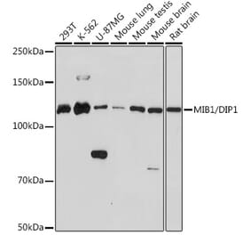Western Blot - Anti-Mib1/Mindbomb Antibody [ARC1958] (A307813) - Antibodies.com