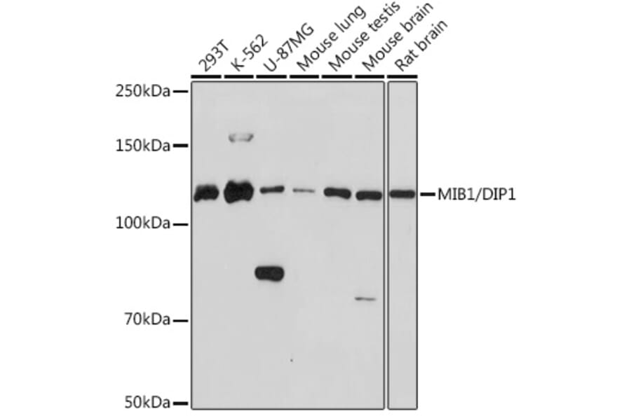 Western Blot - Anti-Mib1/Mindbomb Antibody [ARC1958] (A307813) - Antibodies.com