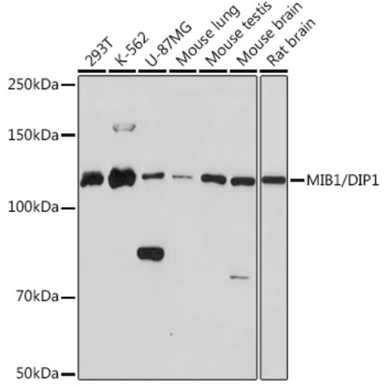 Western Blot - Anti-Mib1/Mindbomb Antibody [ARC1958] (A307813) - Antibodies.com