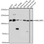 Western Blot - Anti-Mib1/Mindbomb Antibody [ARC1958] (A307813) - Antibodies.com