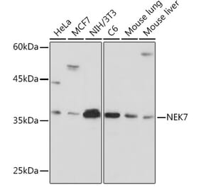 Western Blot - Anti-NEK7 Antibody [ARC2342] (A307814) - Antibodies.com