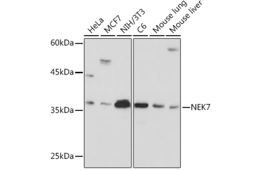 Western Blot - Anti-NEK7 Antibody [ARC2342] (A307814) - Antibodies.com