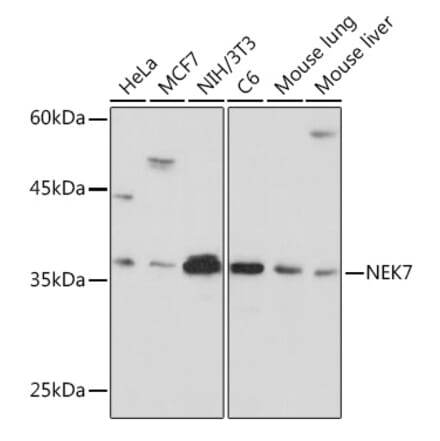 Western Blot - Anti-NEK7 Antibody [ARC2342] (A307814) - Antibodies.com
