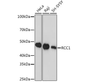 Western Blot - Anti-RCC1 Antibody [ARC1834] (A307816) - Antibodies.com