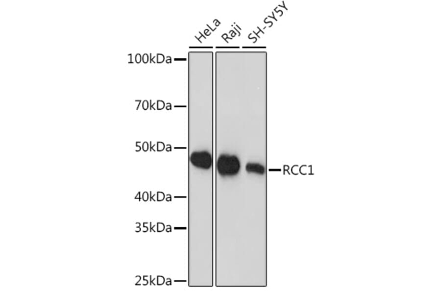Western Blot - Anti-RCC1 Antibody [ARC1834] (A307816) - Antibodies.com