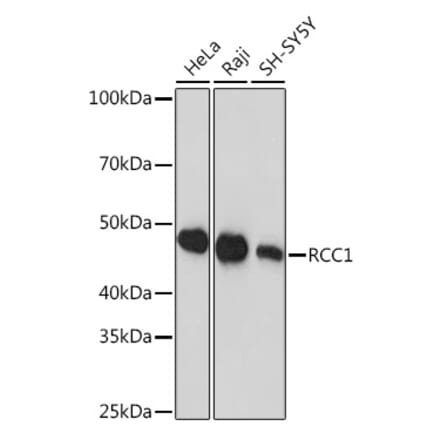 Western Blot - Anti-RCC1 Antibody [ARC1834] (A307816) - Antibodies.com