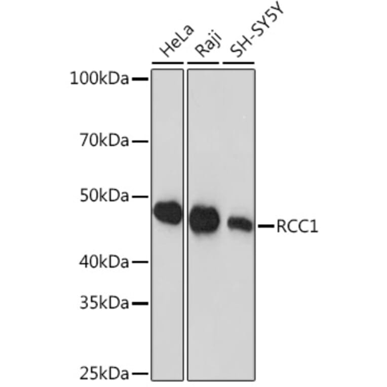 Western Blot - Anti-RCC1 Antibody [ARC1834] (A307816) - Antibodies.com