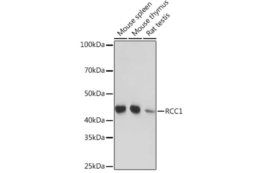 Western Blot - Anti-RCC1 Antibody [ARC1834] (A307816) - Antibodies.com
