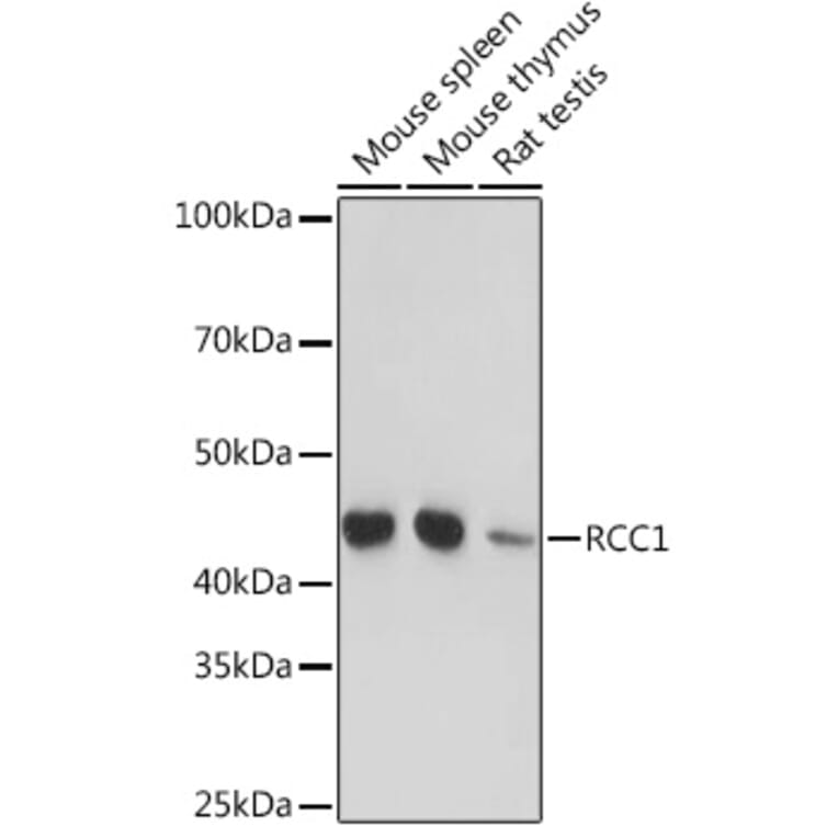 Western Blot - Anti-RCC1 Antibody [ARC1834] (A307816) - Antibodies.com