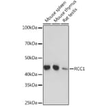 Western Blot - Anti-RCC1 Antibody [ARC1834] (A307816) - Antibodies.com