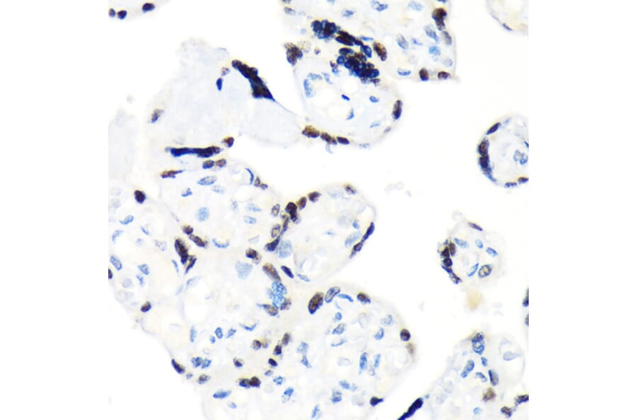 Immunohistochemistry - Anti-RCC1 Antibody [ARC1834] (A307816) - Antibodies.com