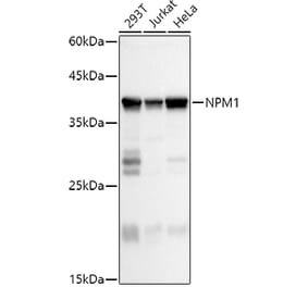 Western Blot - Anti-Nucleophosmin Antibody (A307817) - Antibodies.com