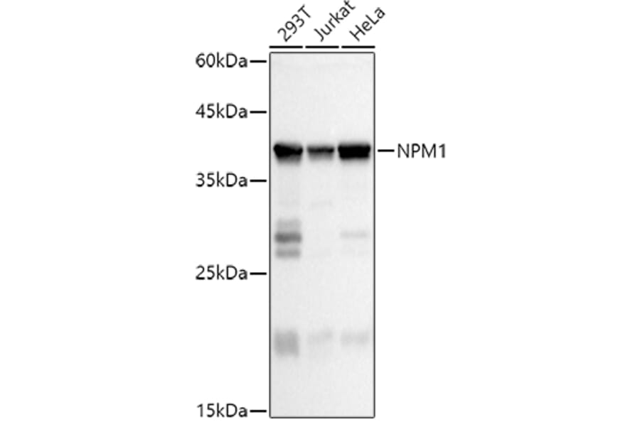 Western Blot - Anti-Nucleophosmin Antibody (A307817) - Antibodies.com