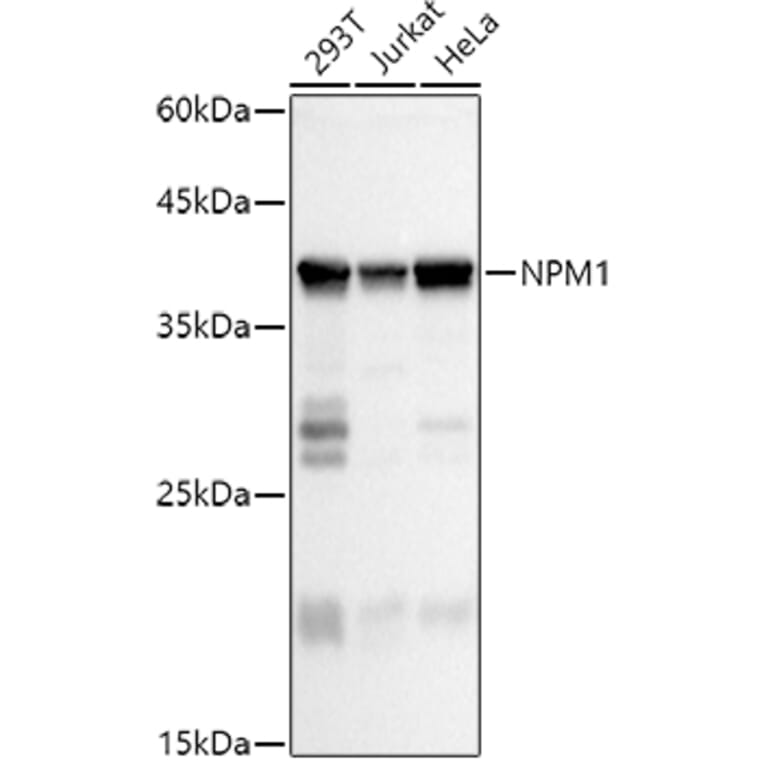 Western Blot - Anti-Nucleophosmin Antibody (A307817) - Antibodies.com