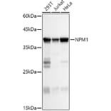 Western Blot - Anti-Nucleophosmin Antibody (A307817) - Antibodies.com
