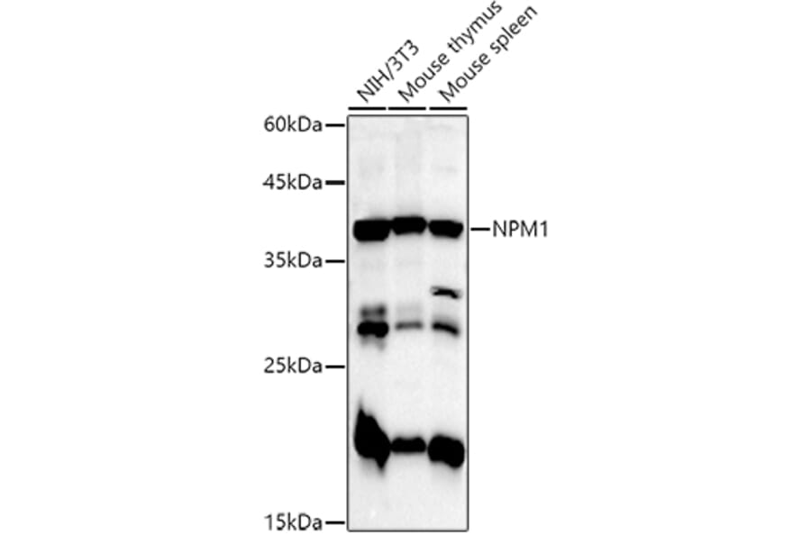 Western Blot - Anti-Nucleophosmin Antibody (A307817) - Antibodies.com