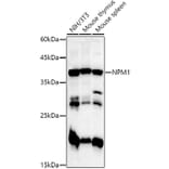 Western Blot - Anti-Nucleophosmin Antibody (A307817) - Antibodies.com