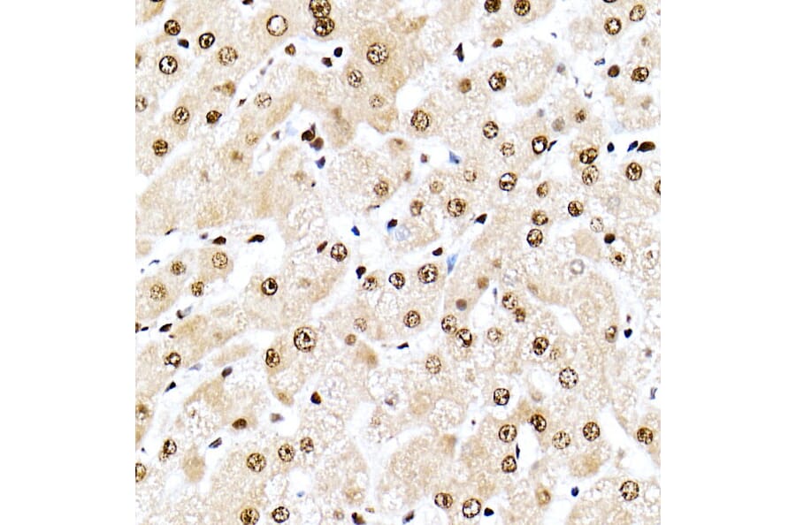 Immunohistochemistry - Anti-Nucleophosmin Antibody (A307817) - Antibodies.com