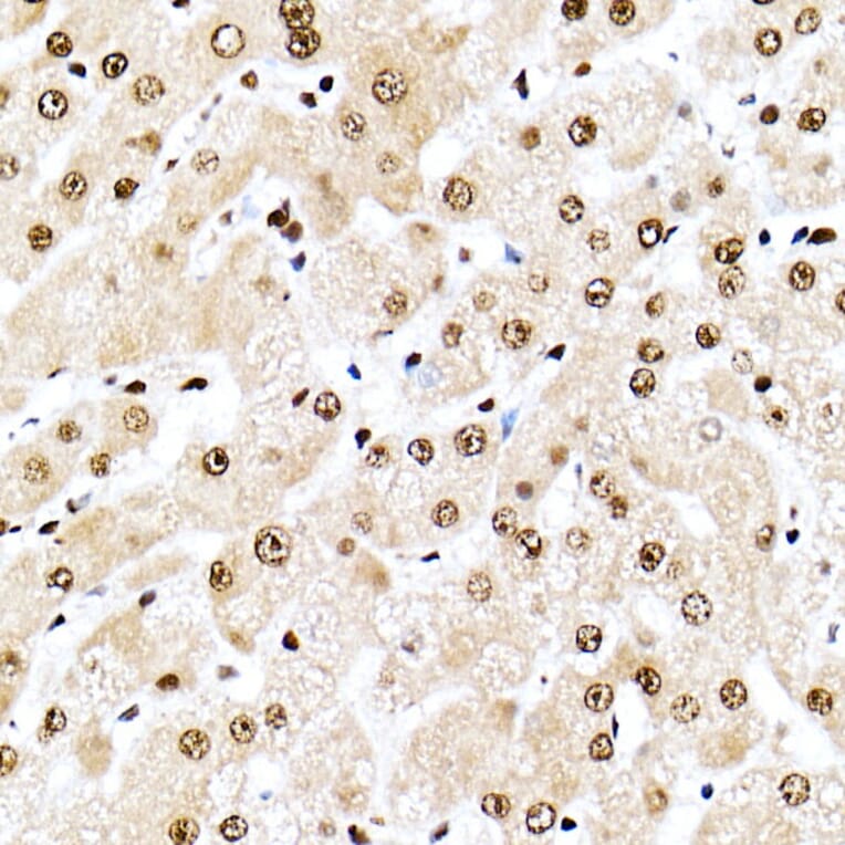 Immunohistochemistry - Anti-Nucleophosmin Antibody (A307817) - Antibodies.com