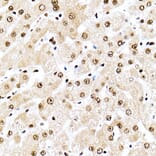 Immunohistochemistry - Anti-Nucleophosmin Antibody (A307817) - Antibodies.com