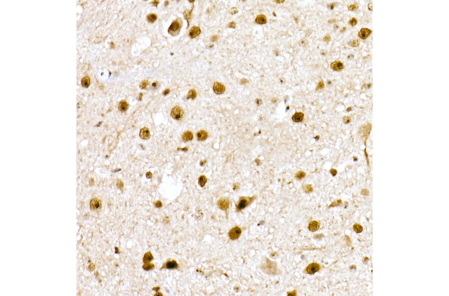 Immunohistochemistry - Anti-Nucleophosmin Antibody (A307817) - Antibodies.com
