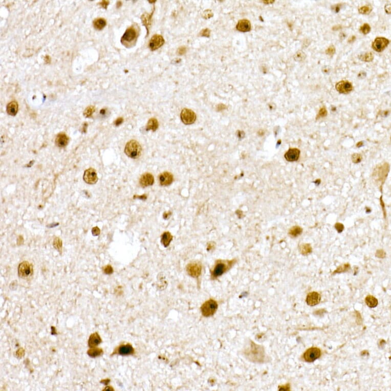 Immunohistochemistry - Anti-Nucleophosmin Antibody (A307817) - Antibodies.com