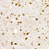Immunohistochemistry - Anti-Nucleophosmin Antibody (A307817) - Antibodies.com
