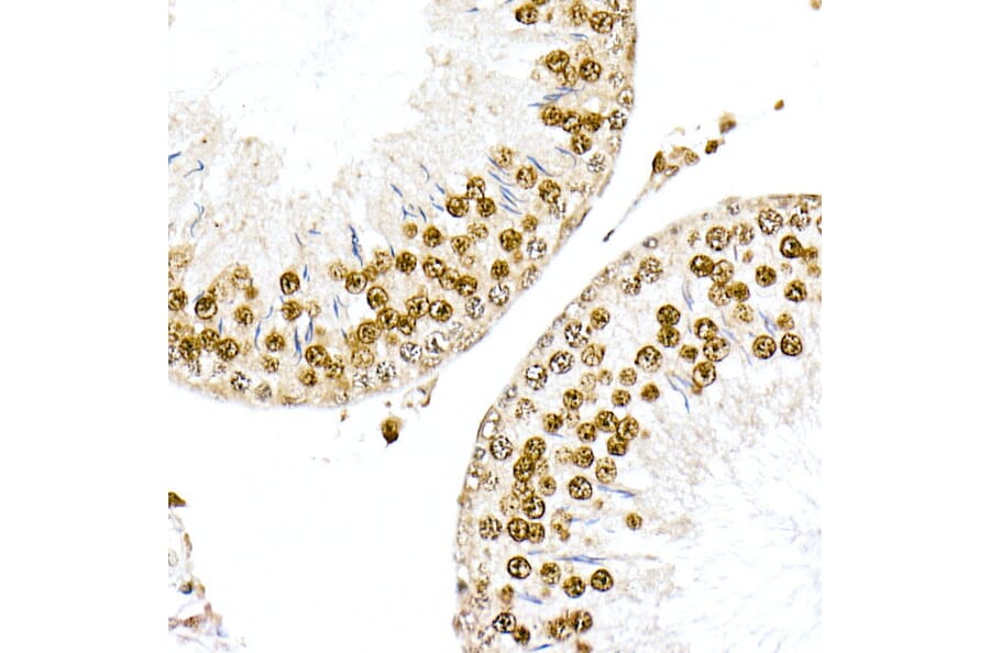 Immunohistochemistry - Anti-Nucleophosmin Antibody (A307817) - Antibodies.com