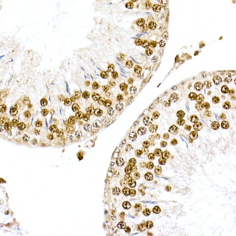 Immunohistochemistry - Anti-Nucleophosmin Antibody (A307817) - Antibodies.com