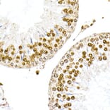 Immunohistochemistry - Anti-Nucleophosmin Antibody (A307817) - Antibodies.com