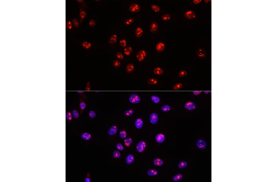 Immunofluorescence - Anti-Nucleophosmin Antibody (A307817) - Antibodies.com