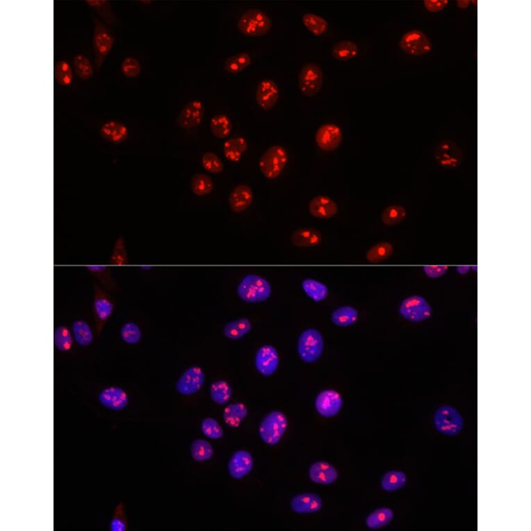 Immunofluorescence - Anti-Nucleophosmin Antibody (A307817) - Antibodies.com