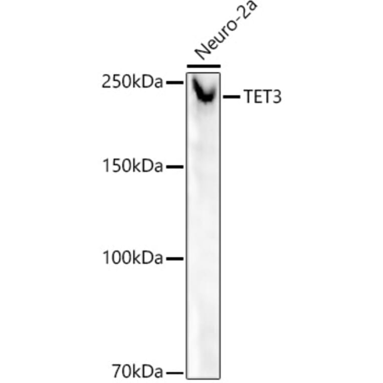 Western Blot - Anti-TET3 Antibody [ARC52663] (A307820) - Antibodies.com