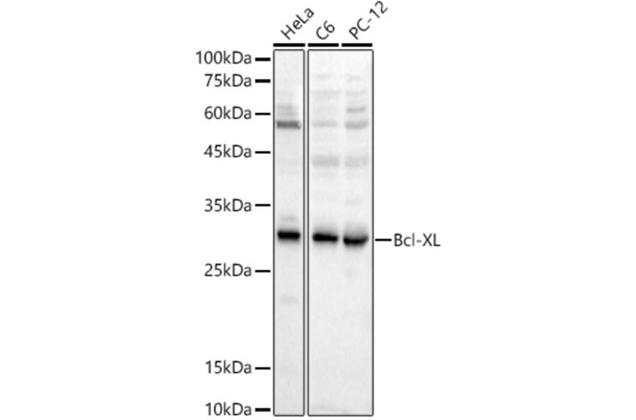 Western Blot - Anti-Bcl-XL Antibody (A307822) - Antibodies.com