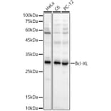 Western Blot - Anti-Bcl-XL Antibody (A307822) - Antibodies.com