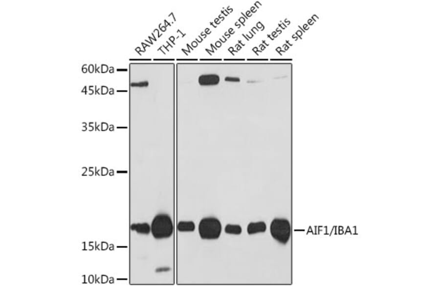Western Blot - Anti-Iba1 Antibody [ARC2301] (A307823) - Antibodies.com