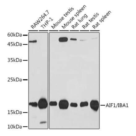 Western Blot - Anti-Iba1 Antibody [ARC2301] (A307823) - Antibodies.com