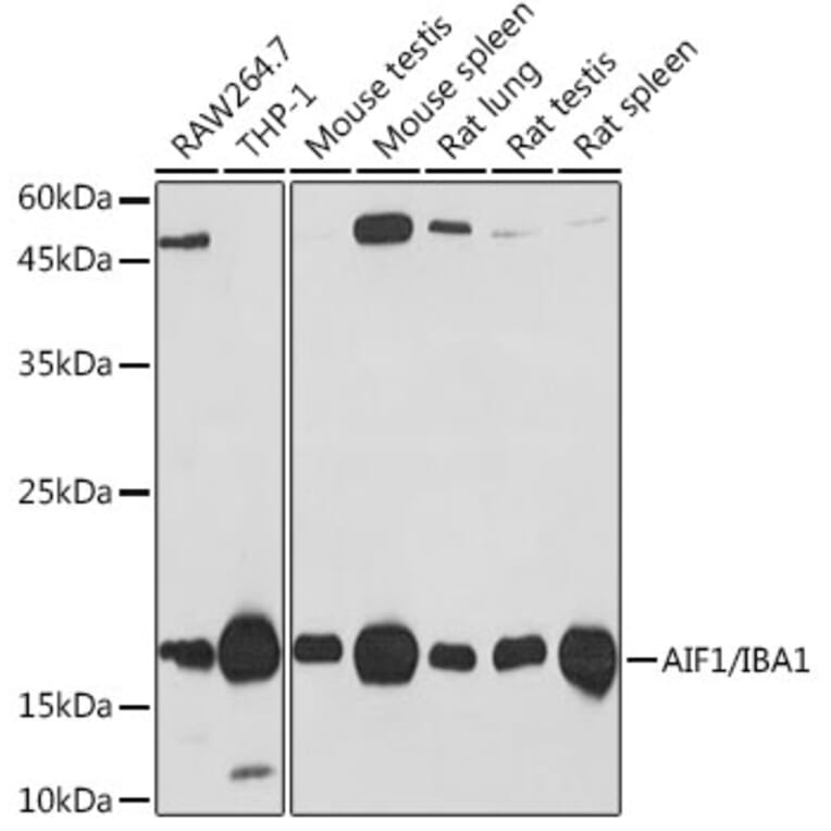 Western Blot - Anti-Iba1 Antibody [ARC2301] (A307823) - Antibodies.com