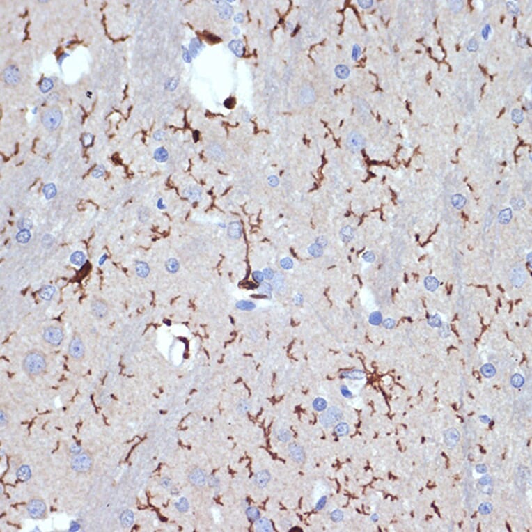 Immunohistochemistry - Anti-Iba1 Antibody [ARC2301] (A307823) - Antibodies.com