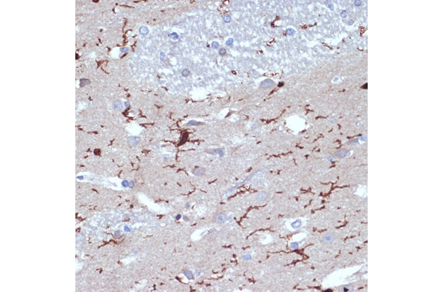 Immunohistochemistry - Anti-Iba1 Antibody [ARC2301] (A307823) - Antibodies.com